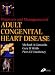 Diagnosis and Management of Adult Congenital Heart Disease