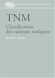 TNM : Classification des tumeurs malignes