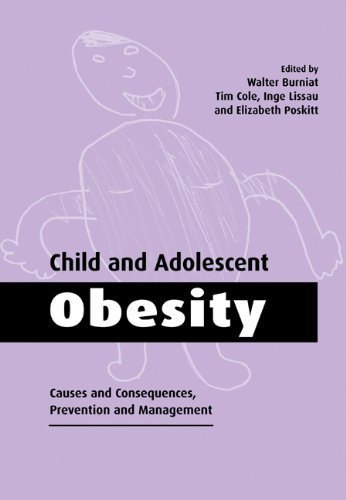 Child and Adolescent Obesity: Causes and Consequences, Prevention and Management 1st Edition by Burniat, Walter published by Cambridge University Press