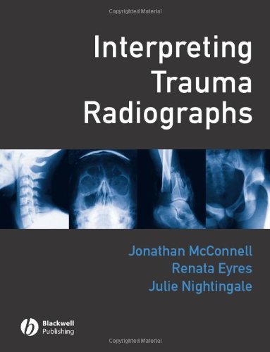 Interpreting Trauma Radiographs