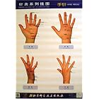 Series Chart of Acupuncture: Hand Needle by  Wang Fuchun