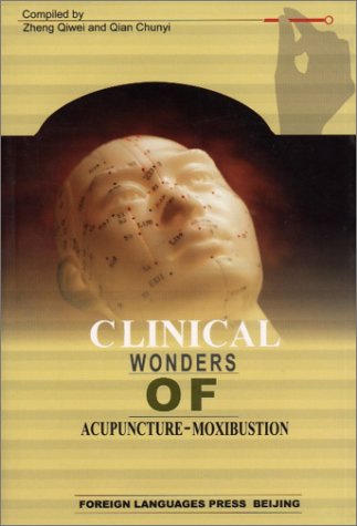 Acupuncture and Chinese Medicine