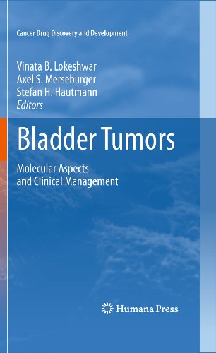 Bladder Tumors:: Molecular Aspects and Clinical Management (Cancer Drug Discovery and Development)