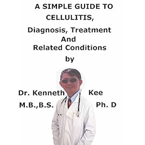 A  Simple  Guide  To  Cellulitis,  Diagnosis, Treatment  And  Related Conditions (A Simple Guide to Medical Conditions)