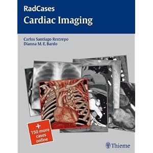 Click here to buy Cardiac Imaging (RadCases) by Carlos Restrepo and Dianna Bardo.