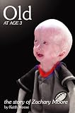 Old at Age 3, the story of Zachary Moore Old at Age 3, the story of Zachary Moore
