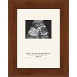 Sonogram by Unknown