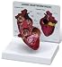 Heartworm Disease Model