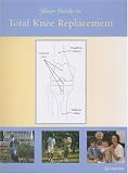 Your Guide to Total Knee Replacement