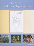 Your Guide to Total Knee Replacement (Your Guide to)