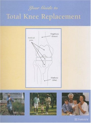 Your Guide to Total Knee Replacement (Your Guide to)