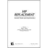 hip replacement current trends and controversies