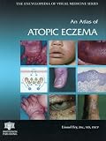 Atlas of Atopic Eczema
