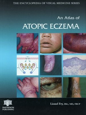 Dermatology