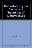 Understanding the causes and treatment of kidney failure