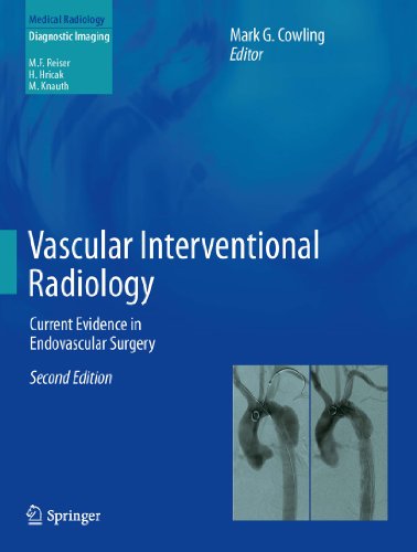 Vascular Interventional Radiology: Current Evidence in Endovascular Surgery (Medical Radiology)