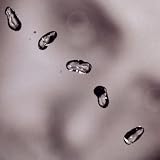 Uppar Peter Gabriel