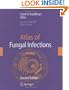 Atlas of Fungal Infection
