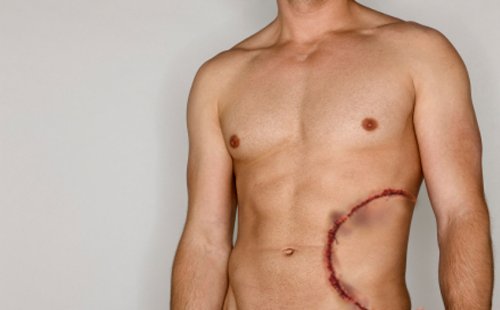 Stitched Great White Shark Bite Temporary Tattoo Pack - 1 2pc Bite Wound Tattoo Per Pack Stitched Great White Shark Bite Temporary Tattoo Pack - 1 2pc Bite Wound Tattoo Per Pack