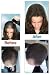 FIXPLANT Keratin Hair Building Fibers Dark Brown, Hair Loss Concealer. The 30 Second "HAIR TRANSPLANT" Regular Size 25 gm, 0.88 oz - Get Rid of Bald Spots in Seconds!