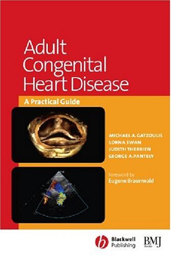 Congenital-Heart-Disease
