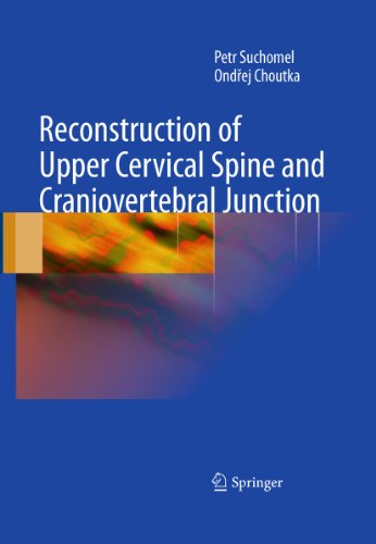 Reconstruction of Upper Cervical Spine and Craniovertebral Junction On Sale