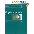 Onychomycosis: The Current Approach to Diagnosis and Therapy