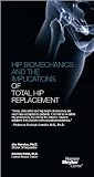 Hip Biomechanics and the Implications of Total Hip Replacement