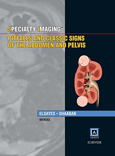 Specialty Imaging: Pitfalls and Classic Signs of the Abdomen and Pelvis