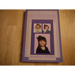 Birthmarks: A Guide to Hemangiomas & Vascular Malformations by Linda Rozell Shannon