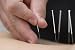 41bEhwHmwiL. SL75  Acupuncture For Pain: How To Achieve Quality Of Life
