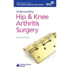 Hip and Knee Arthritis Surgery (Understanding)