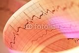 IMAGE OF Wallmonkeys Peel and Stick Wall Decals - Ecg Print - 36