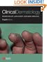 Clinical Dermatology