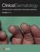 Clinical Dermatology