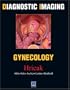 Diagnostic Imaging: Gynecology, 1e