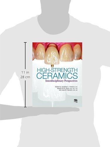 High-Strength Ceramics: A Collaboration of Science, Industry, Clinical, and Laboratory Expertise