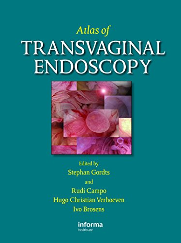 Atlas of Transvaginal Endoscopy