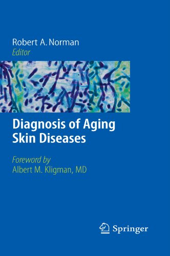 Diagnosis of Aging Skin Diseases