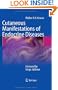 Cutaneous Manifestations of Endocrine Diseases