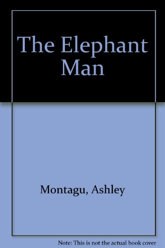 the elephant man
