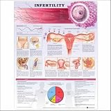 Chart Infertility Chart Infertility