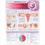 Understanding Infertility Chart