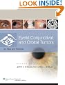 Eyelid, Conjunctival, and Orbital Tumors and Intraocular Tumors: An Atlas and Text