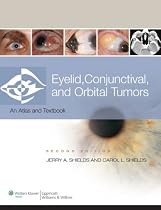 Eyelid, Conjunctival, and Orbital Tumors and Intraocular Tumors: An Atlas and Text