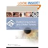 Eyelid, Conjunctival, and Orbital Tumors: An Atlas and Text