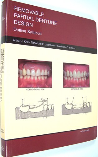 Removable Partial Denture Design: Outline Syllabus