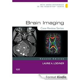 Brain Imaging: Case Review Series
