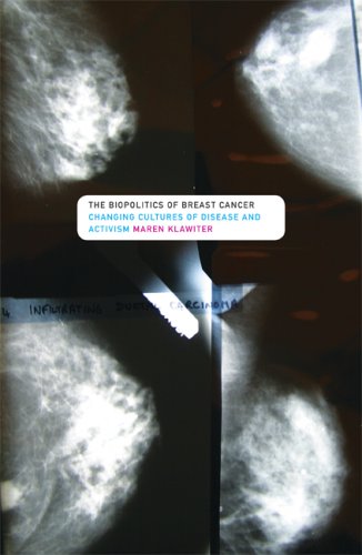 Biopolitics of Breast Cancer: Changing Cultures of Disease and Activism