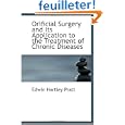 urethral sounds Orificial Surgery urethral sounds Orificial Surgery